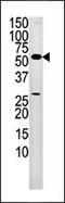 Pantothenate Kinase 2 antibody, 62-695, ProSci, Western Blot image 