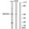 Coenzyme Q8A antibody, PA5-49853, Invitrogen Antibodies, Western Blot image 