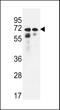 Patatin Like Phospholipase Domain Containing 8 antibody, LS-C163828, Lifespan Biosciences, Western Blot image 