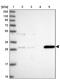 Glutathione S-Transferase Omega 2 antibody, PA5-61664, Invitrogen Antibodies, Western Blot image 