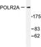 RNA Polymerase II Subunit A antibody, AP06407PU-N, Origene, Western Blot image 