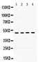 MYCN Proto-Oncogene, BHLH Transcription Factor antibody, PB9728, Boster Biological Technology, Western Blot image 