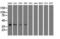 3-Hydroxyisobutyryl-CoA Hydrolase antibody, LS-C115328, Lifespan Biosciences, Western Blot image 