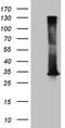 2,4-Dienoyl-CoA Reductase 1 antibody, LS-C791867, Lifespan Biosciences, Western Blot image 