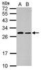 Spermatogenesis Associated 46 antibody, GTX107187, GeneTex, Western Blot image 