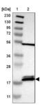 Peptidyl-tRNA hydrolase 2, mitochondrial antibody, NBP1-88595, Novus Biologicals, Western Blot image 