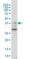 DnaJ Heat Shock Protein Family (Hsp40) Member B2 antibody, H00003300-M03, Novus Biologicals, Western Blot image 