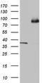 Ald antibody, LS-C789970, Lifespan Biosciences, Western Blot image 