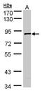 SCY1 Like Pseudokinase 3 antibody, NBP1-33190, Novus Biologicals, Western Blot image 