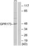 Probable G-protein coupled receptor 173 antibody, LS-C120618, Lifespan Biosciences, Western Blot image 