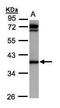 Aldo-keto reductase family 1 member C1 antibody, TA308032, Origene, Western Blot image 