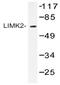 LIM Domain Kinase 2 antibody, AP20423PU-N, Origene, Western Blot image 
