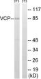 Valosin Containing Protein antibody, LS-C118380, Lifespan Biosciences, Western Blot image 