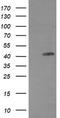 EGFR antibody, TA506209S, Origene, Western Blot image 