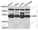 Histidyl-tRNA synthetase, cytoplasmic antibody, A7899, ABclonal Technology, Western Blot image 