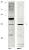 HUS1 Checkpoint Clamp Component B antibody, GTX48745, GeneTex, Western Blot image 