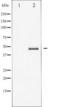 Glycogen Synthase Kinase 3 Beta antibody, TA326007, Origene, Western Blot image 