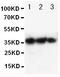 Erythropoietin antibody, RP1004, Boster Biological Technology, Western Blot image 