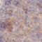 Hyaluronate receptor antibody, FNab10089, FineTest, Immunohistochemistry paraffin image 