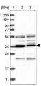 PAK1 Interacting Protein 1 antibody, PA5-56349, Invitrogen Antibodies, Western Blot image 