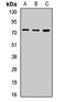 Lipolysis-stimulated lipoprotein receptor antibody, LS-C668396, Lifespan Biosciences, Western Blot image 