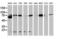 Catenin Beta 1 antibody, LS-C172582, Lifespan Biosciences, Western Blot image 