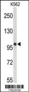 Heat Shock Protein Family H (Hsp110) Member 1 antibody, MBS9211270, MyBioSource, Western Blot image 
