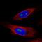 Zinc Finger Protein 57 antibody, NBP2-56710, Novus Biologicals, Immunocytochemistry image 
