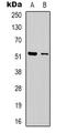 Dematin Actin Binding Protein antibody, LS-C368799, Lifespan Biosciences, Western Blot image 