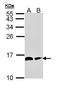 NADH:Ubiquinone Oxidoreductase Subunit AB1 antibody, orb72214, Biorbyt, Western Blot image 