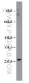Peroxisomal Biogenesis Factor 11 Gamma antibody, 15744-1-AP, Proteintech Group, Western Blot image 