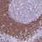 B-cell scaffold protein with ankyrin repeats antibody, NBP1-88714, Novus Biologicals, Immunohistochemistry frozen image 