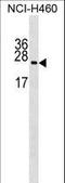Ribosomal Protein L10a antibody, LS-C162696, Lifespan Biosciences, Western Blot image 