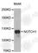 Notch Receptor 1 antibody, A2349, ABclonal Technology, Western Blot image 