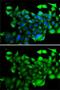 Chloride Intracellular Channel 4 antibody, GTX33100, GeneTex, Immunocytochemistry image 