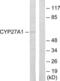 Sterol 26-hydroxylase, mitochondrial antibody, LS-B13330, Lifespan Biosciences, Western Blot image 