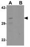 C-Type Lectin Domain Family 2 Member A antibody, GTX32085, GeneTex, Western Blot image 