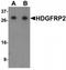 HDGF Like 2 antibody, TA320056, Origene, Western Blot image 