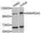 Ankyrin Repeat Domain 44 antibody, LS-C410056, Lifespan Biosciences, Western Blot image 