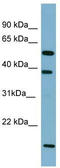 Solute Carrier Family 10 Member 1 antibody, TA346341, Origene, Western Blot image 
