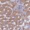 Ribosomal Protein L8 antibody, NBP2-47297, Novus Biologicals, Immunohistochemistry paraffin image 