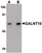 Polypeptide N-Acetylgalactosaminyltransferase 10 antibody, PA5-20785, Invitrogen Antibodies, Western Blot image 
