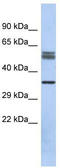Dihydrolipoamide Branched Chain Transacylase E2 antibody, TA340036, Origene, Western Blot image 