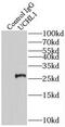 Ubiquitin C-Terminal Hydrolase L1 antibody, FNab09218, FineTest, Immunoprecipitation image 