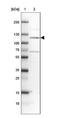 Cadherin Related 23 antibody, NBP1-85704, Novus Biologicals, Western Blot image 
