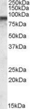 Conserved oligomeric Golgi complex subunit 7 antibody, GTX88563, GeneTex, Western Blot image 