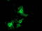 Protein Kinase C Epsilon antibody, TA502395, Origene, Immunofluorescence image 