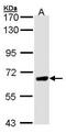 Protein Phosphatase With EF-Hand Domain 1 antibody, PA5-21447, Invitrogen Antibodies, Western Blot image 