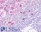 Hydroxycarboxylic acid receptor 3 antibody, LS-A180, Lifespan Biosciences, Immunohistochemistry paraffin image 