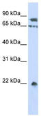 SUMO Specific Peptidase 1 antibody, TA334552, Origene, Western Blot image 